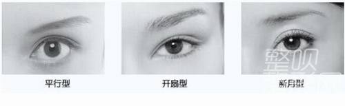 平扇與開扇雙眼皮，哪種更適合你？哪個(gè)更好看？，雙眼皮手術(shù)，平扇與開扇風(fēng)格的選擇與美觀度探討