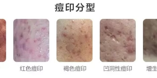 最佳方法