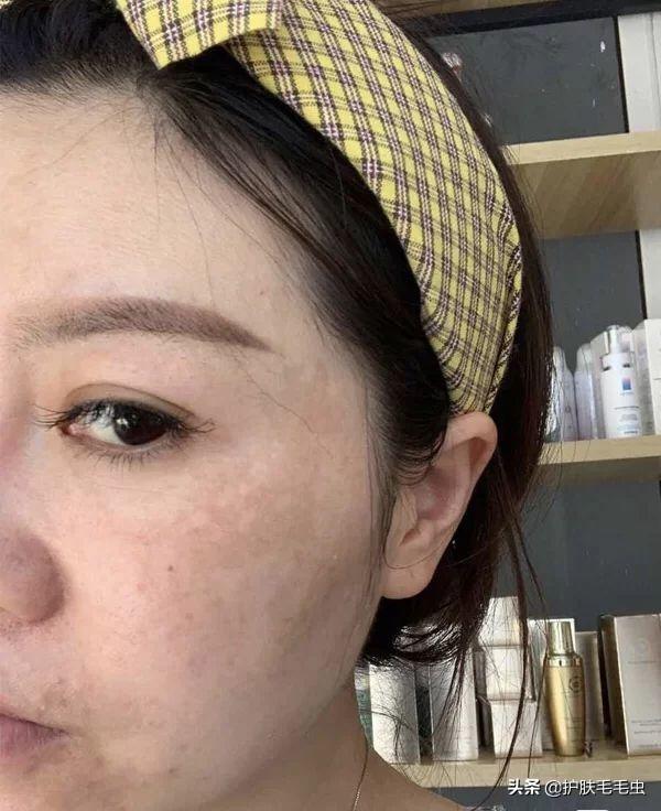 怎樣有效的淡化黃褐斑——全方位美白祛斑攻略，全方位美白祛斑攻略，如何有效淡化黃褐斑