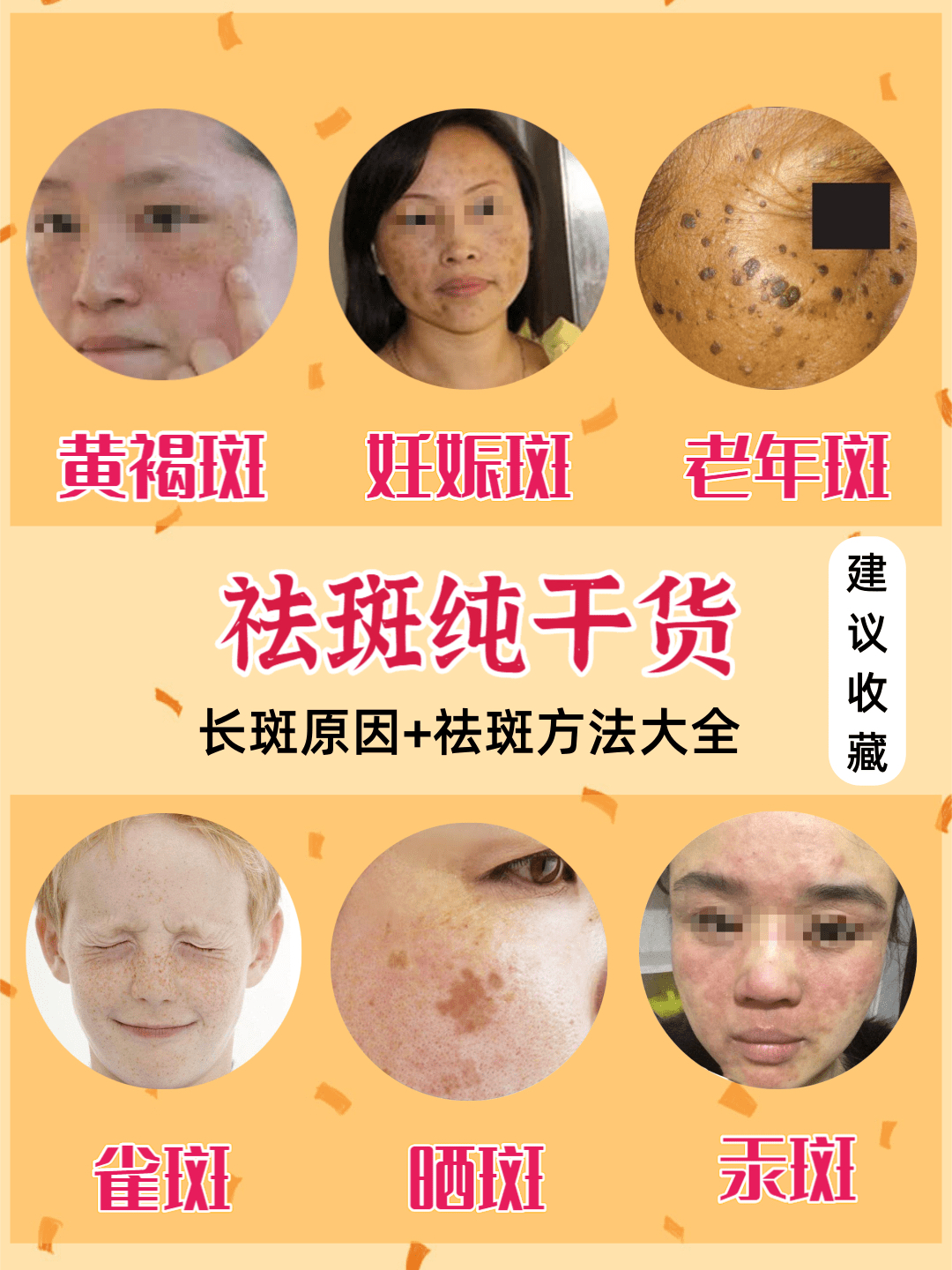揭秘祛斑目前最有效的方法——打造無瑕肌膚，揭秘最有效的祛斑方法，打造完美無瑕肌膚