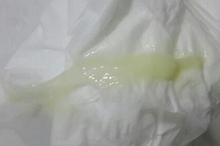 白帶黃綠色的原因及應對方法，了解你的身體狀況，白帶黃綠色原因解析與應對方法，關注你的身體健康