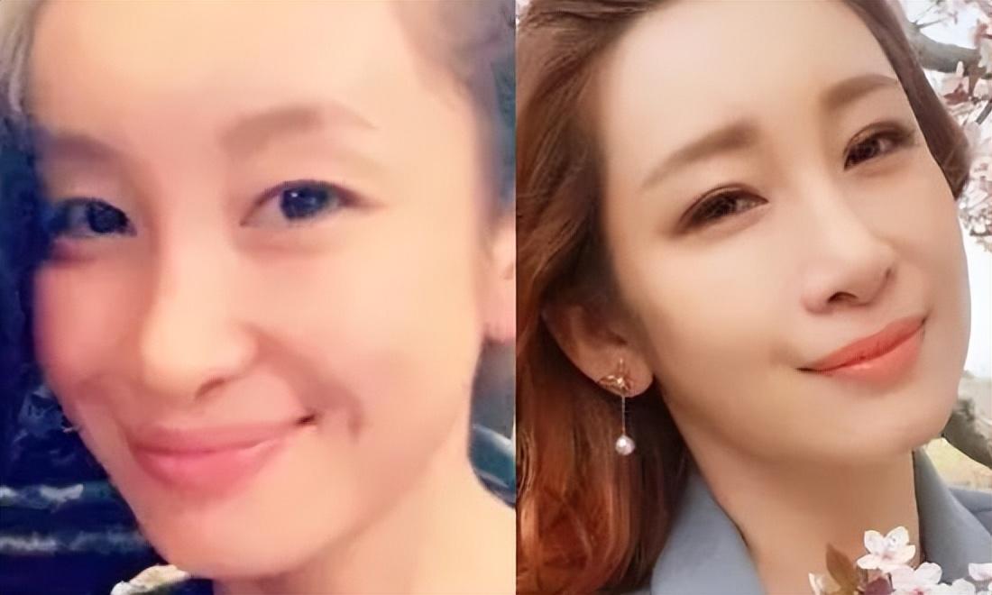 秦海璐割雙眼皮前后對比，揭秘變化之美，秦海璐雙眼皮變化揭秘，前后對比展現(xiàn)美的蛻變