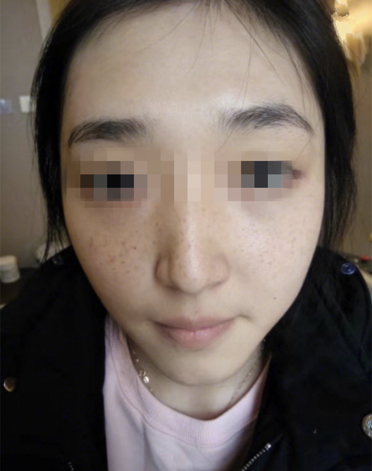 正規(guī)醫(yī)院祛斑效果深度解析，安全與效果的雙重保障，正規(guī)醫(yī)院祛斑效果深度解析，雙重保障下的安全與效果體驗