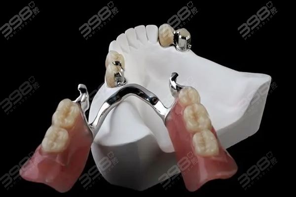 鑲一顆牙大概需要多少錢——全面解析鑲牙費用因素，鑲一顆牙的費用解析，全面探討鑲牙費用因素及大概價格