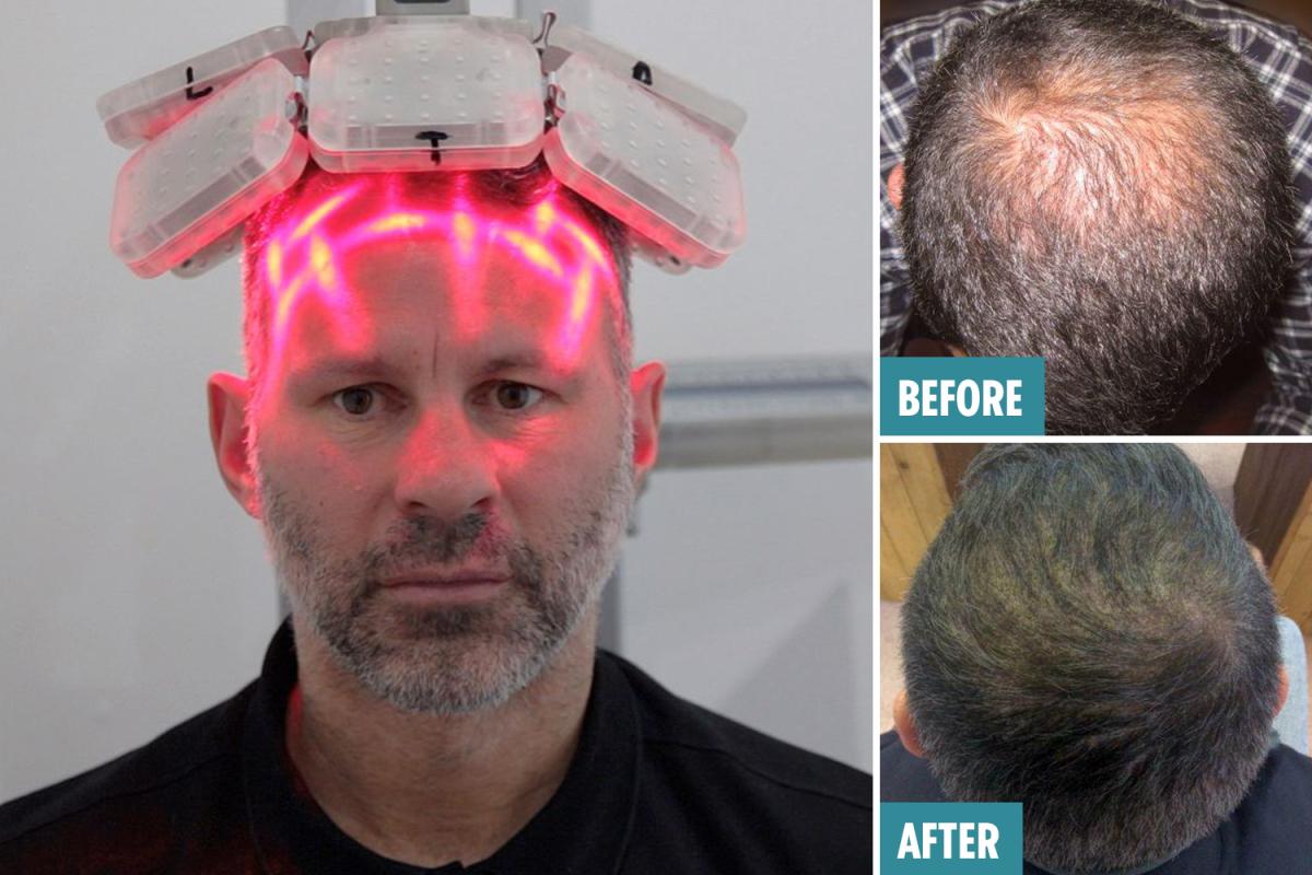 激光手術(shù)費用詳解，多少錢一次？，激光手術(shù)費用全面解析，手術(shù)費用究竟是多少？