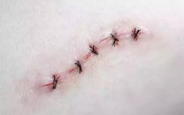 皮膚擦破皮了最快恢復(fù)方法不留疤——專業(yè)指南與實用建議，皮膚擦傷快速恢復(fù)不留疤，專業(yè)指南與實用建議