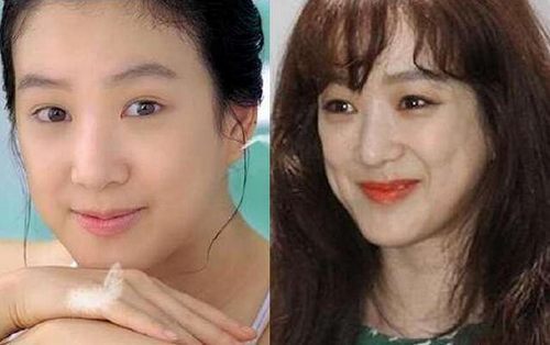 揭秘，韓國(guó)整容失敗的十大明星，揭秘，韓國(guó)整容失敗的明星TOP 10名單曝光