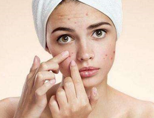 如何去掉青春痘小妙招，實(shí)用指南助你擺脫肌膚困擾，青春痘消除小妙招，實(shí)用指南助你擺脫肌膚問(wèn)題