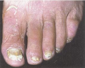 全面解析，100種皮膚病對照表圖片，100種皮膚病對照表圖片，全面解析皮膚病癥狀與類型