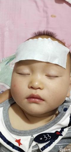 小孩子發(fā)燒39度怎么退燒最快？全面指南與關鍵措施，全面指南，兒童高燒39度快速退燒方法與關鍵措施